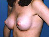 Patient # 16716 After Photo # 2